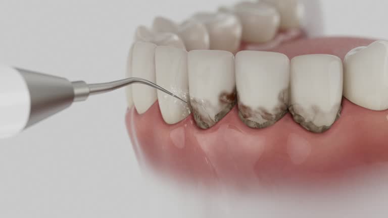 Reliable Dental Implants contractor in Milpitas, CA by Smile Center Dentistry